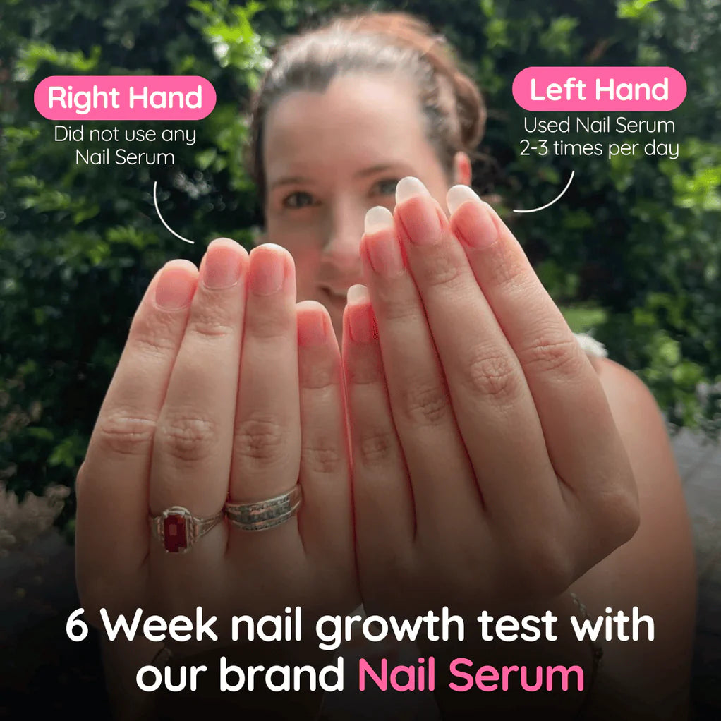 Stem Cells Nail Growth Pen