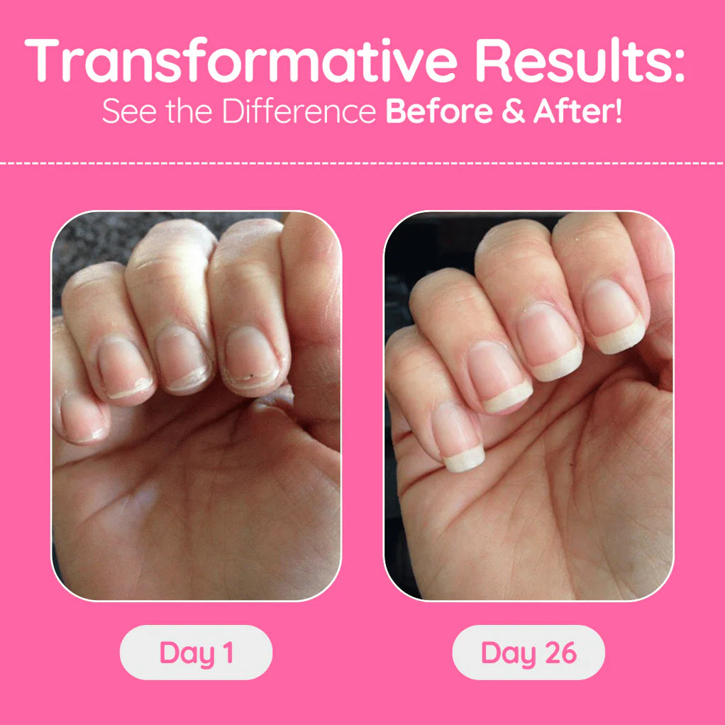Stem Cells Nail Growth Pen