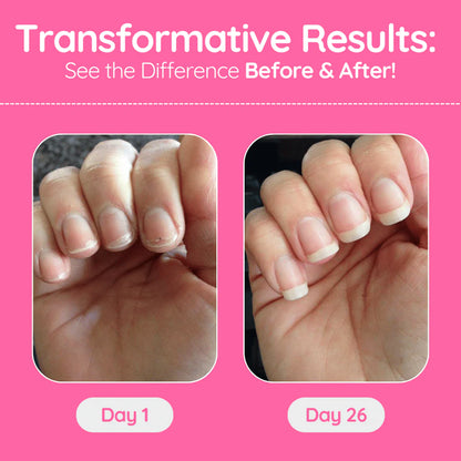 Stem Cells Nail Growth Pen